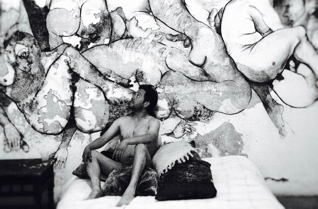 «Hirsuta dermis» de Rocco, una patología de&nbsp;vida